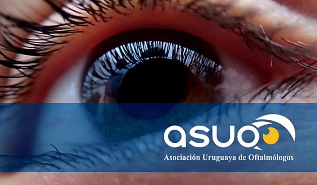"Ama tus ojos": oftalmólogos promueven prevención visual en todas las etapas de la vida