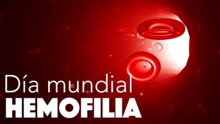 Iluminarán la fachada del edificio comunal por el Día Mundial de la Hemofilia