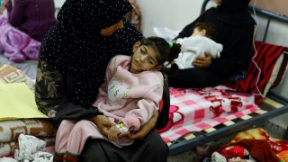 Gaza, Israel, guerra, desnutrición, ONU